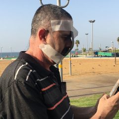 הקשר בין הסלולרי ליובש בעיניים